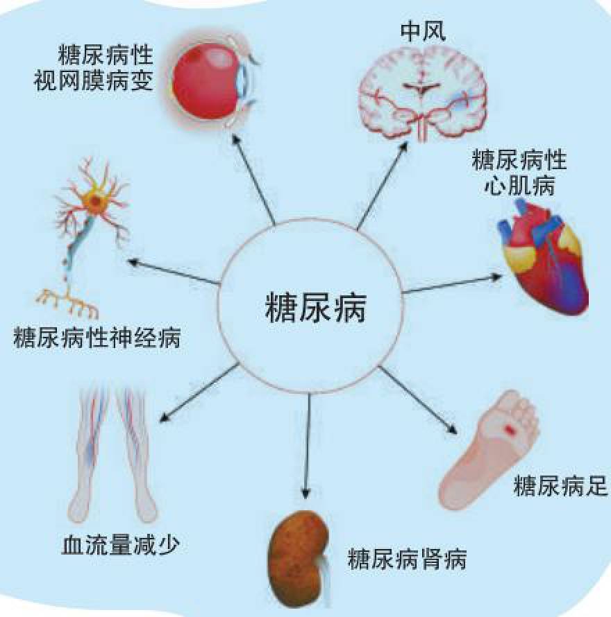 糖尿病病发症.jpeg