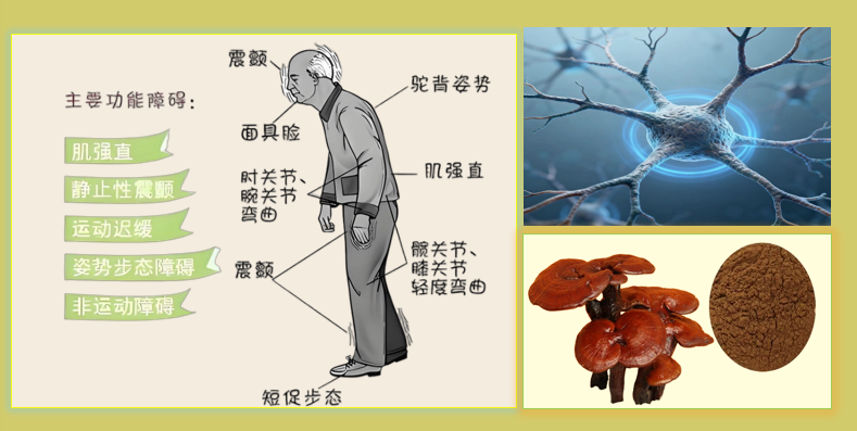灵芝多糖对帕金森病的作用.png